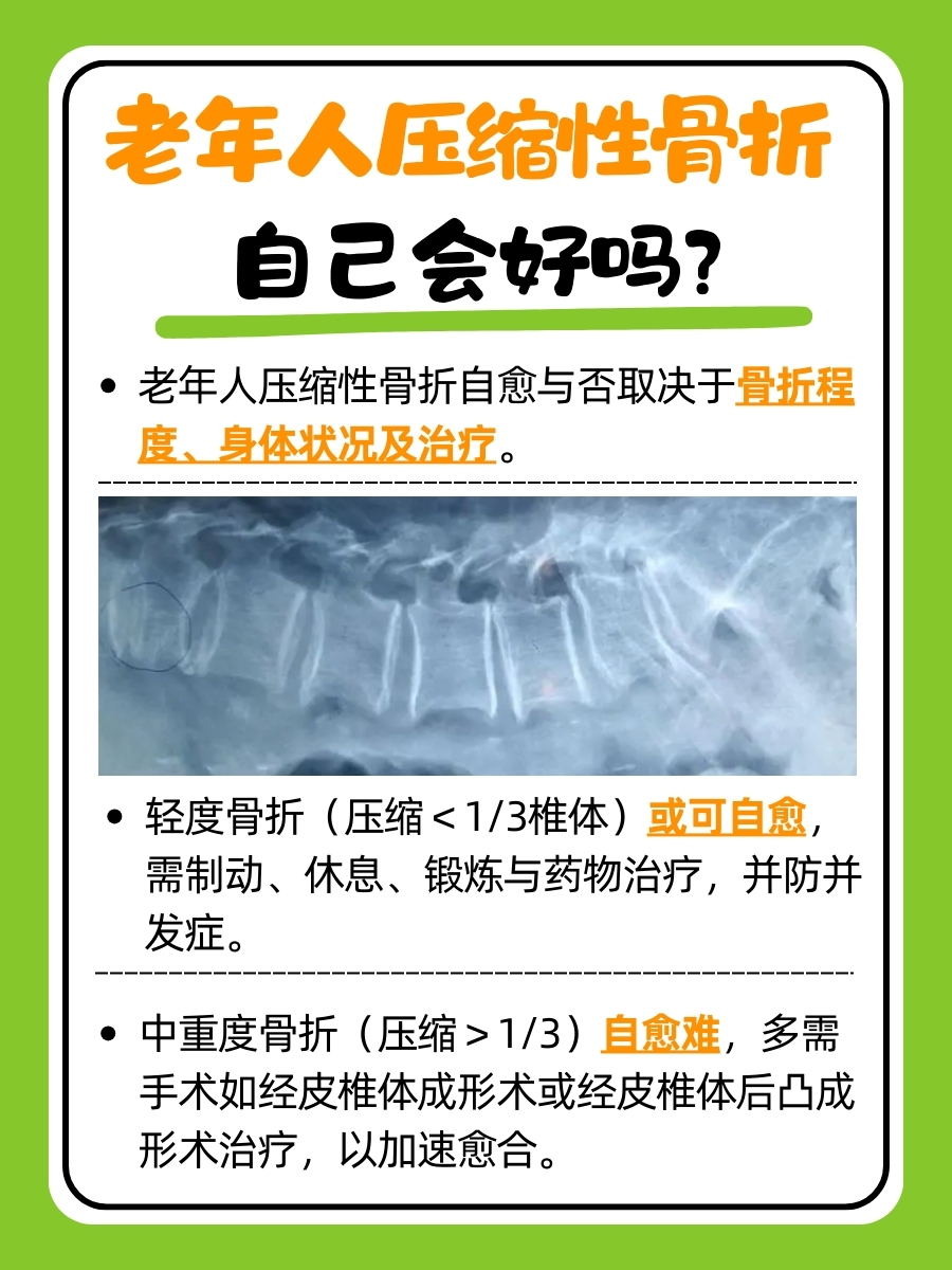 老年人压缩性骨折自愈还是治疗，一文讲透~