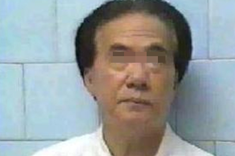 中枢性面神经麻痹图