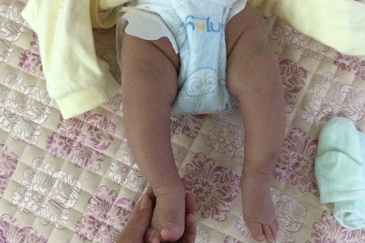 正常儿童腿部图