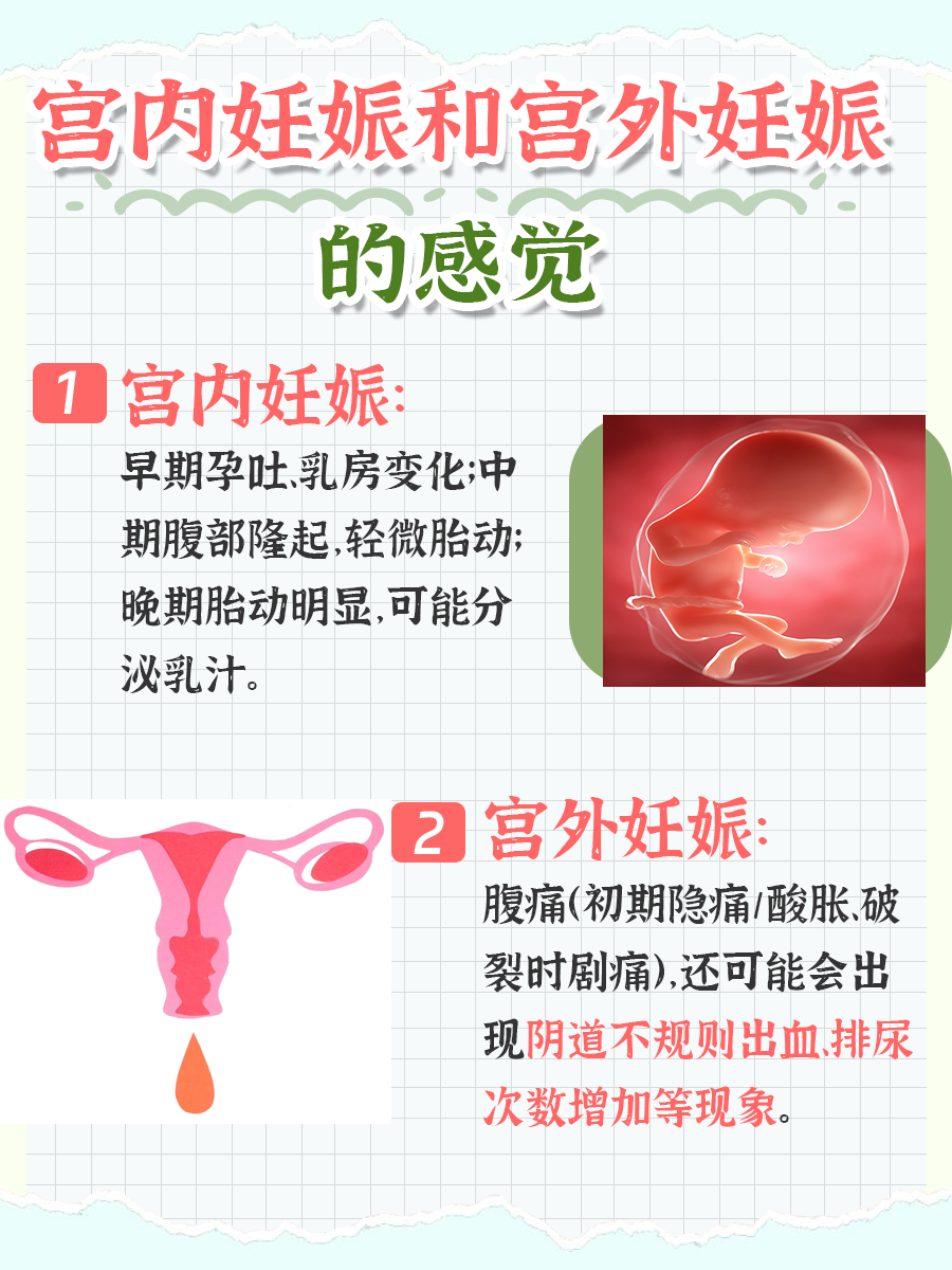 宫内孕VS宫外孕：孕期感受大不同，你知道吗？
