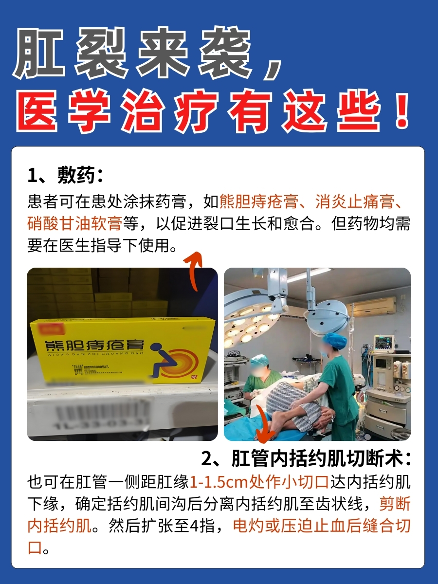 速看！肛裂是否具备自愈能力？