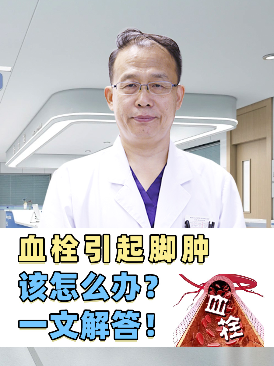 血栓引起脚肿，该怎么办？一文解答！