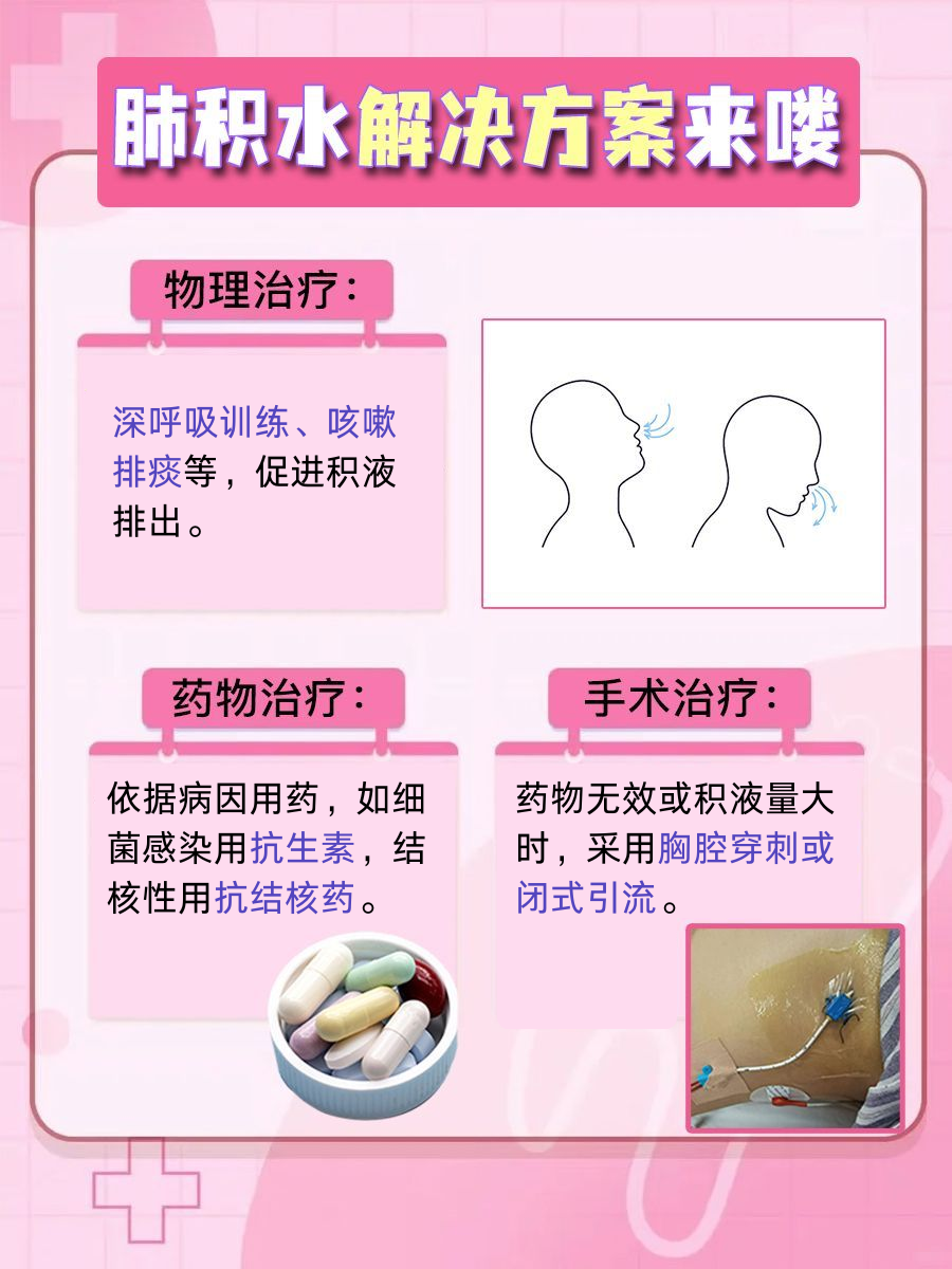 肺积水,是肺里有水了吗?怎么治