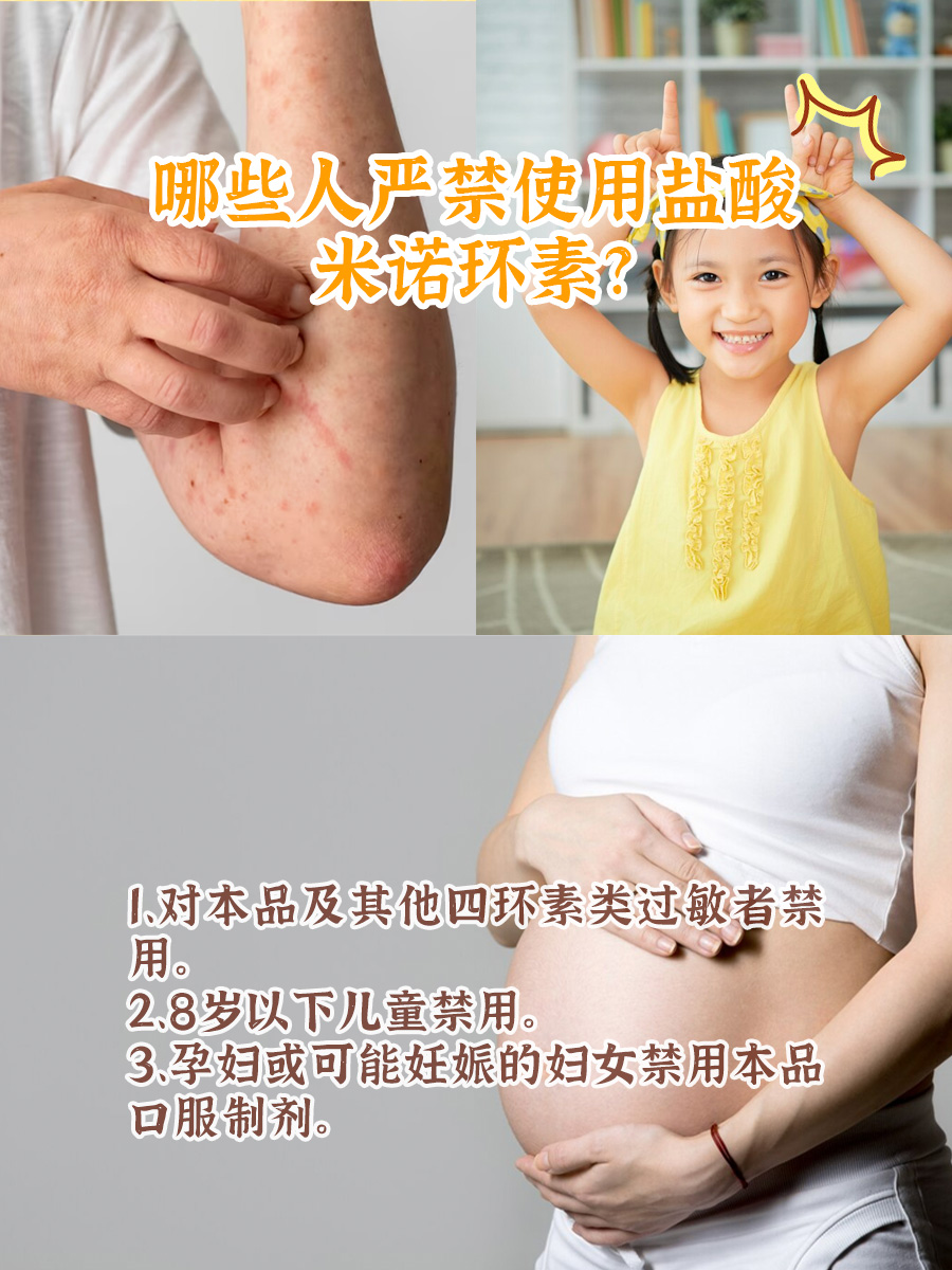 盐酸米诺环素药效这么猛，你真的用对了吗？