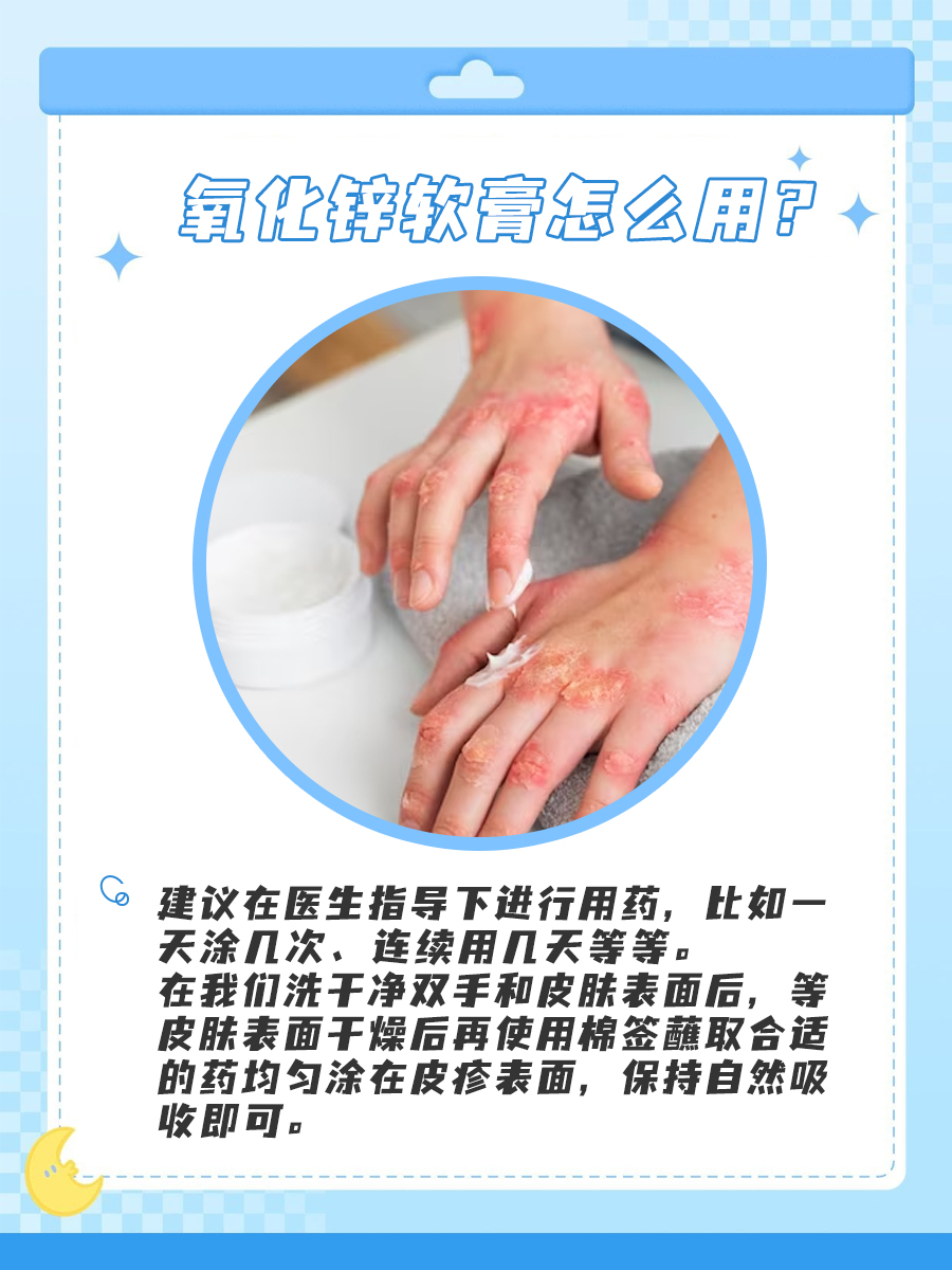 我的湿疹救星：氧化锌软膏