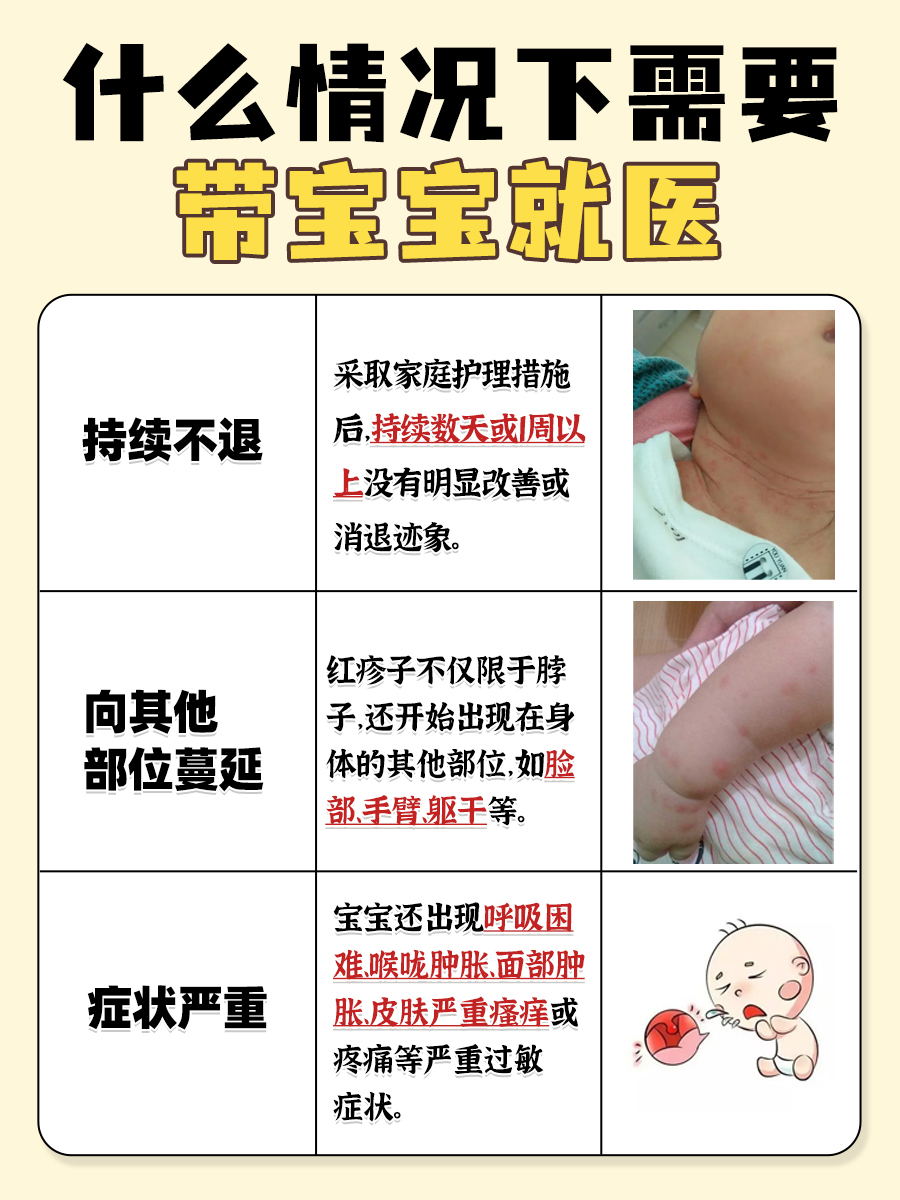 宝宝颈部红疹大救星,速学护理妙招