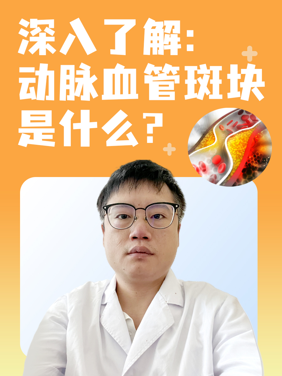 深入了解：动脉血管斑块是什么?