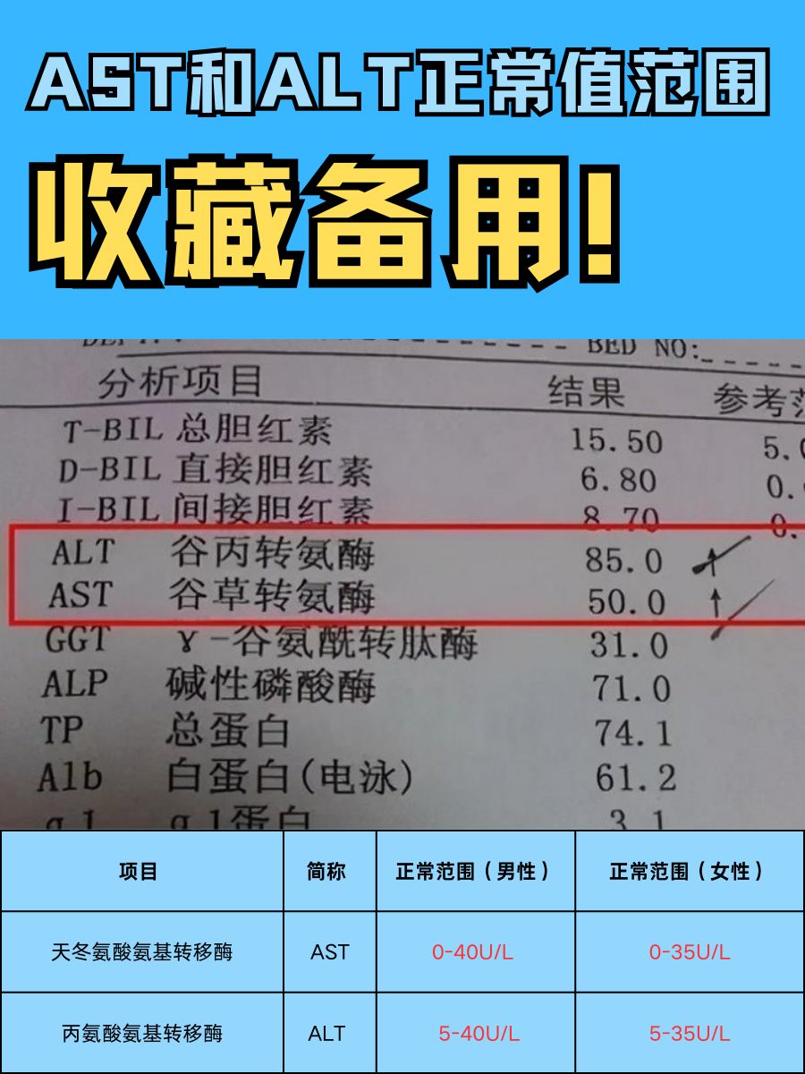 AST和ALT正常值范围，收藏备用！