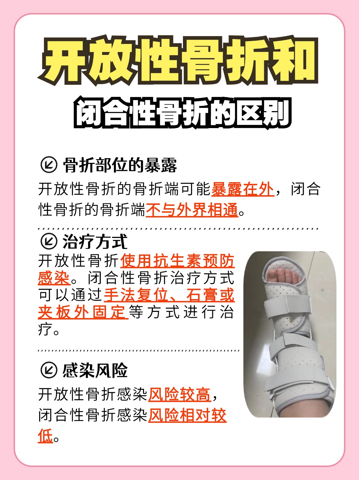 开放性骨折和闭合性骨折，区别在哪里？