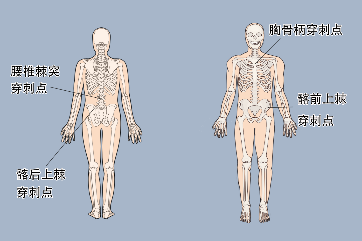 骨髓穿刺部位图