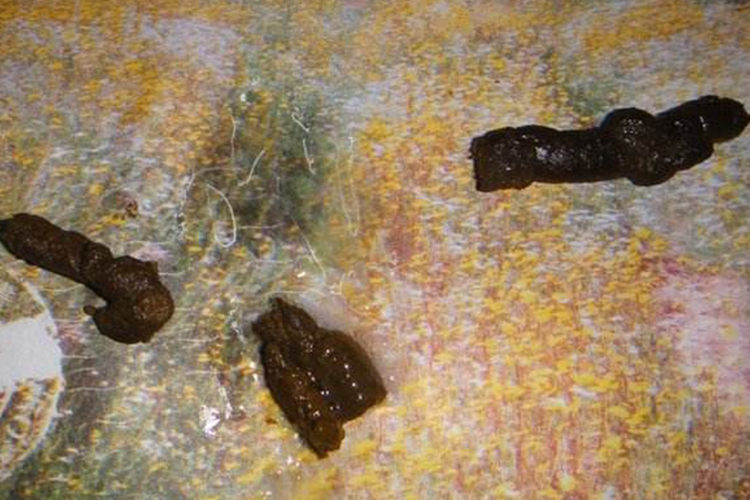 六个月婴儿暗褐色大便图