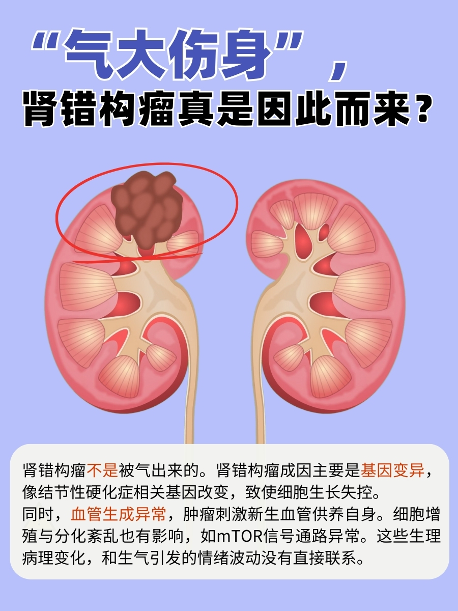 “气大伤身”，肾错构瘤真是因此而来？