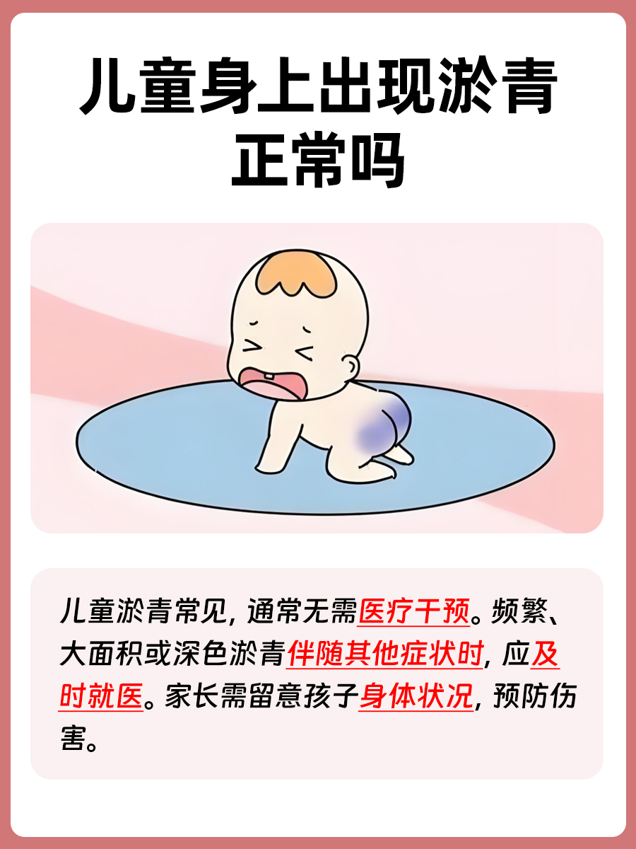 儿童正常淤青图片