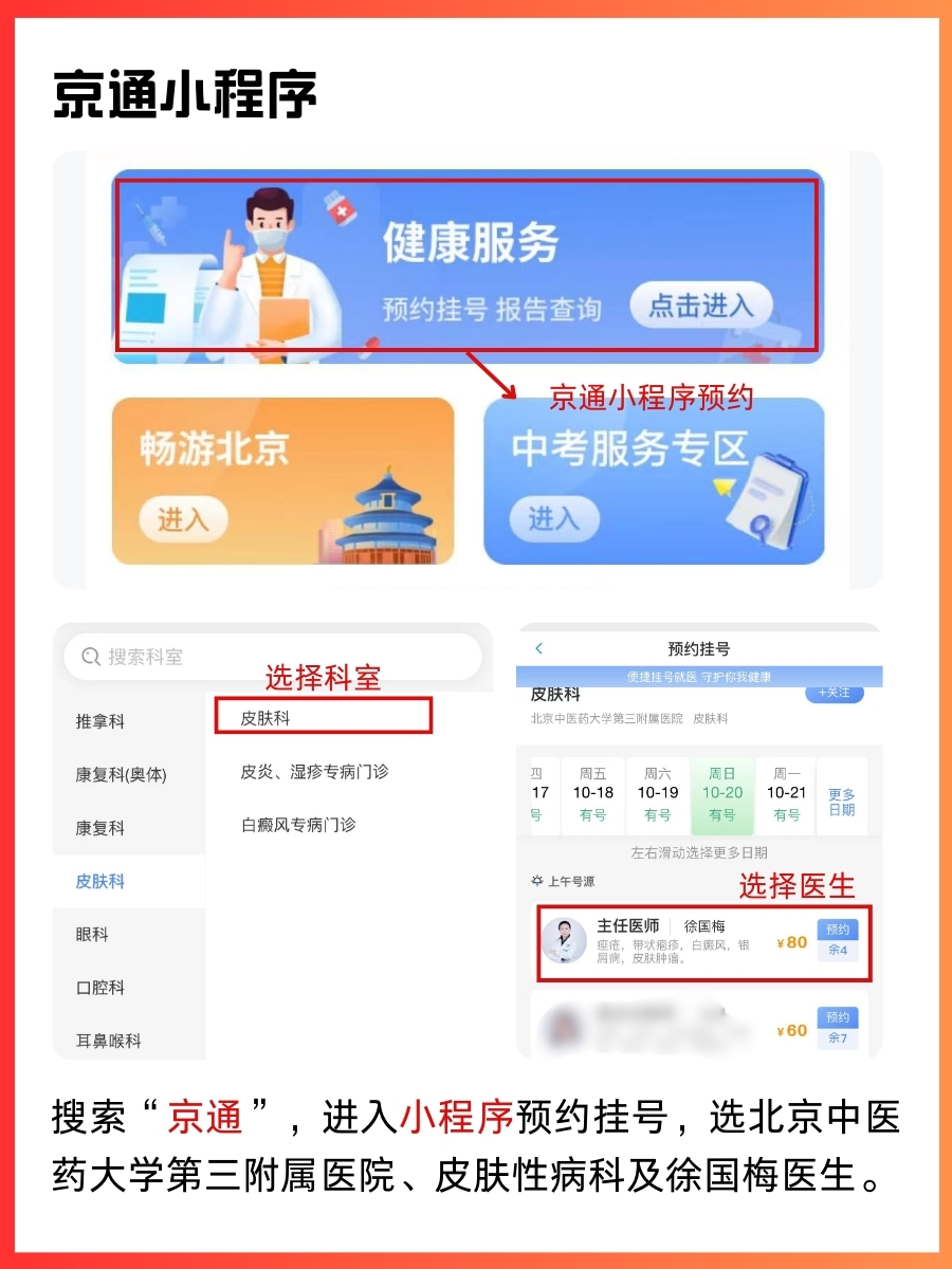北京中医药大学第三附属医院徐国梅医生怎么样？怎么挂号？