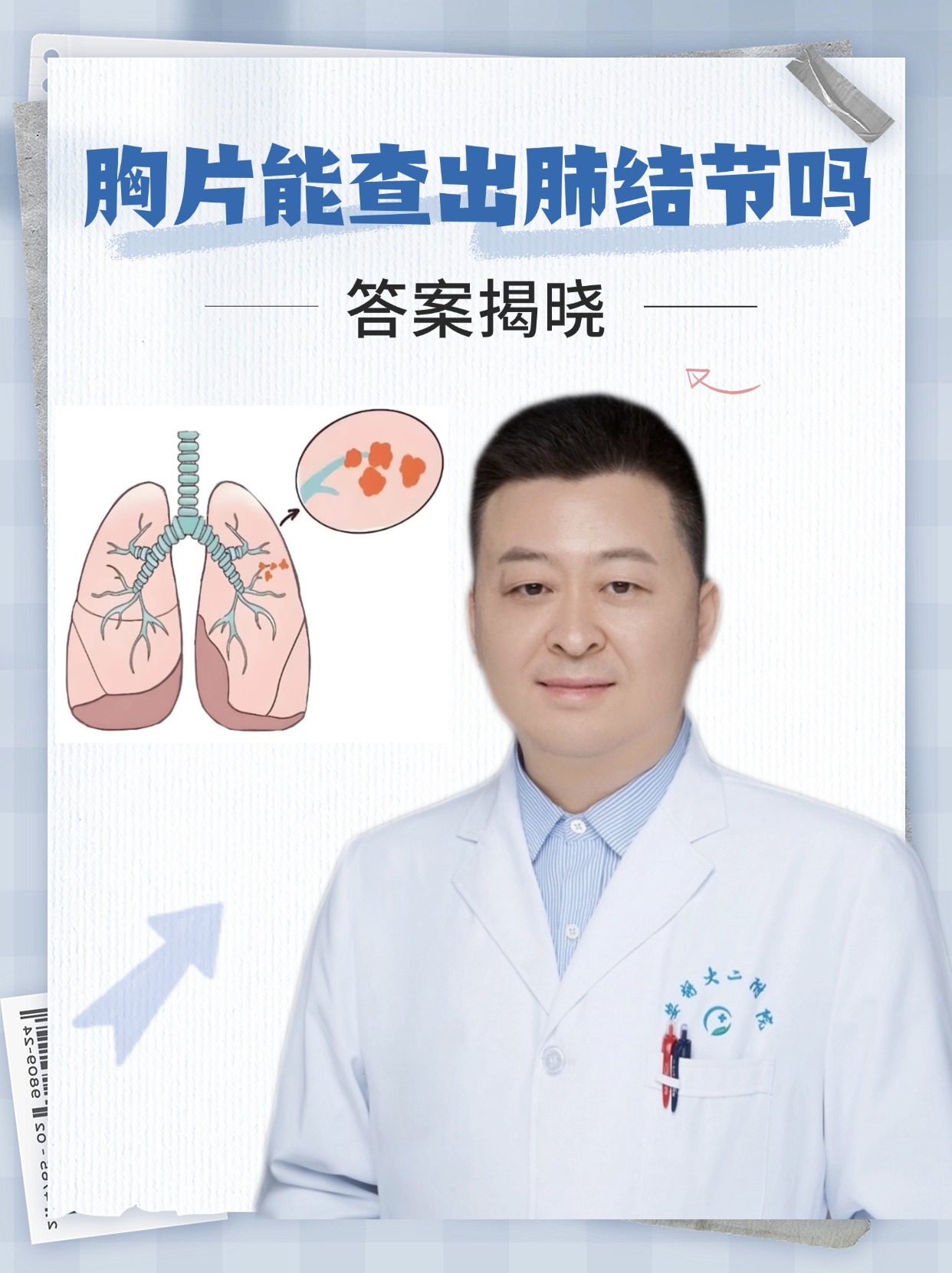 胸片能查出肺结节吗，答案揭晓