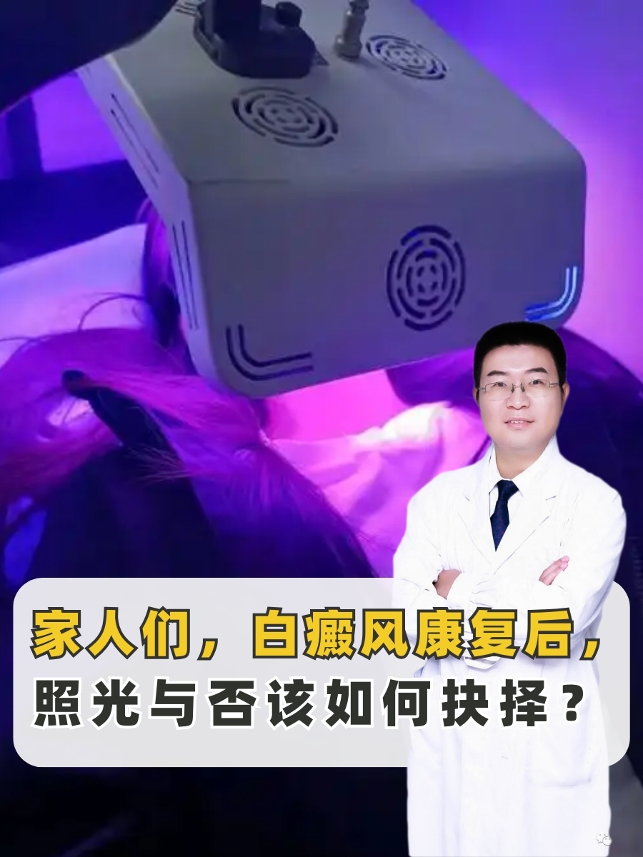 家人们,白癜风康复后,照光与否该如何抉择?