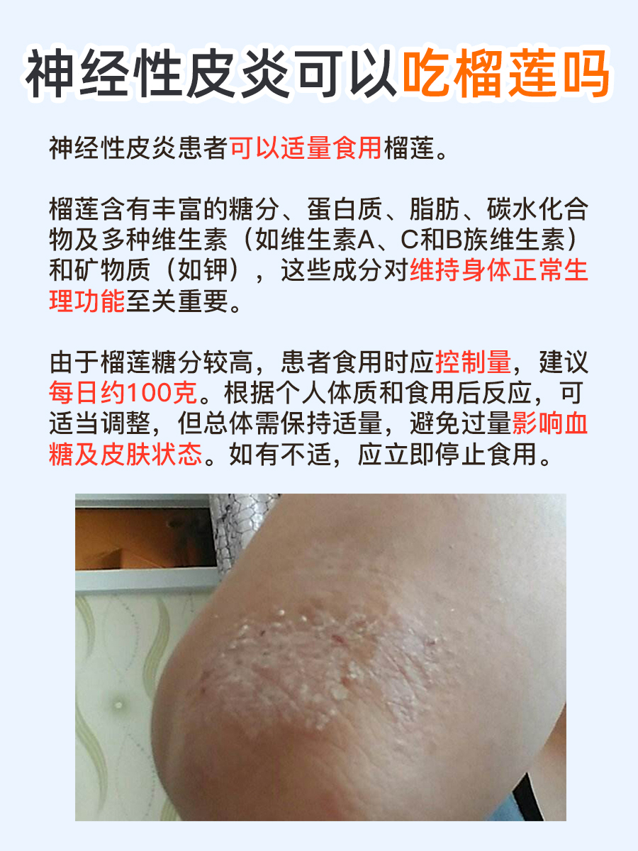 榴莲爱好者注意!神经性皮炎患者能否享用?