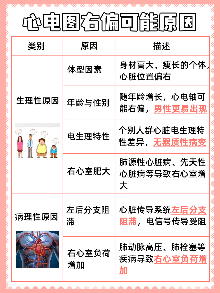 心电图上的小秘密：解读右偏现象