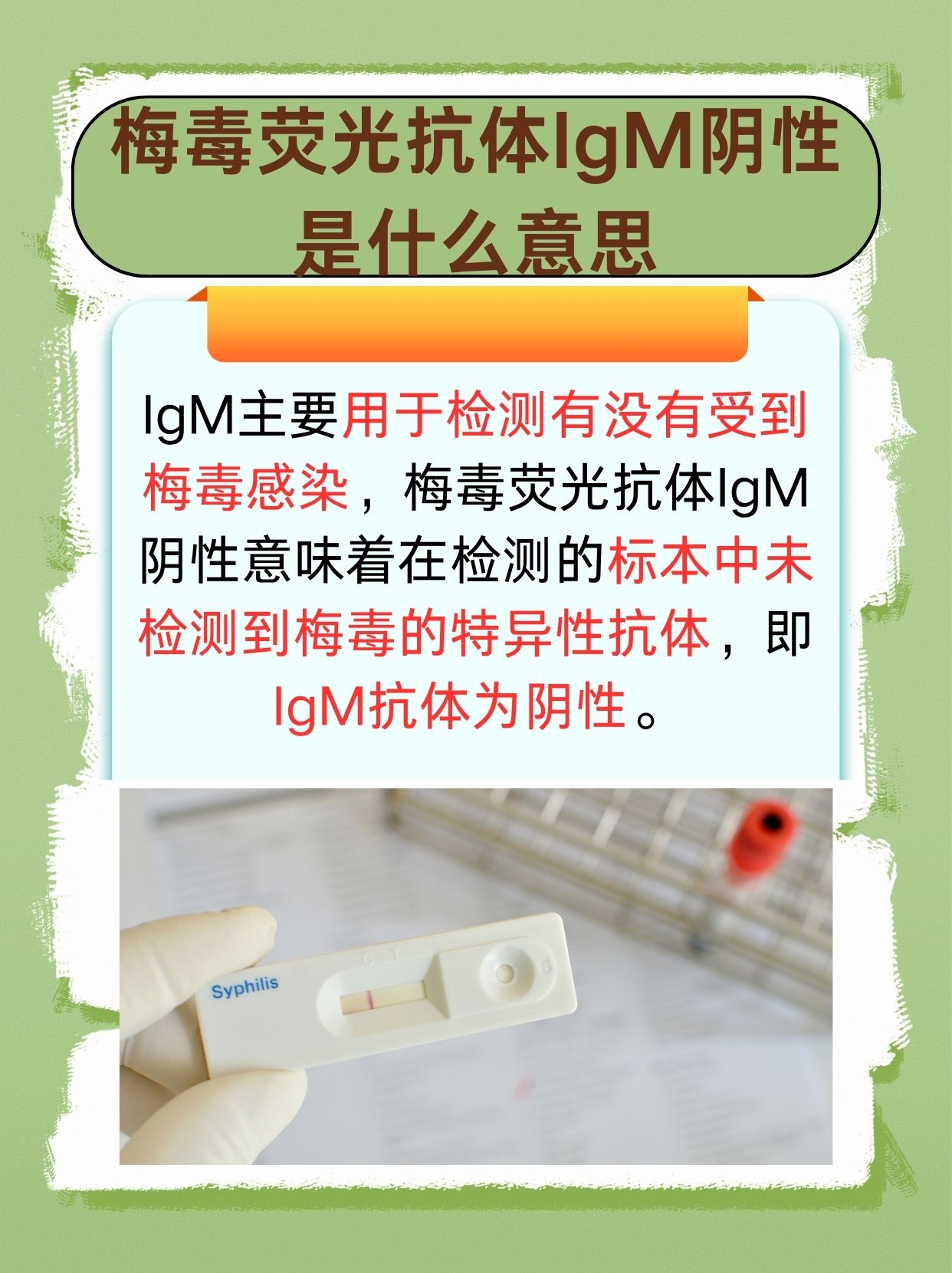 解析：梅毒荧光抗体IgM阴性是什么意思