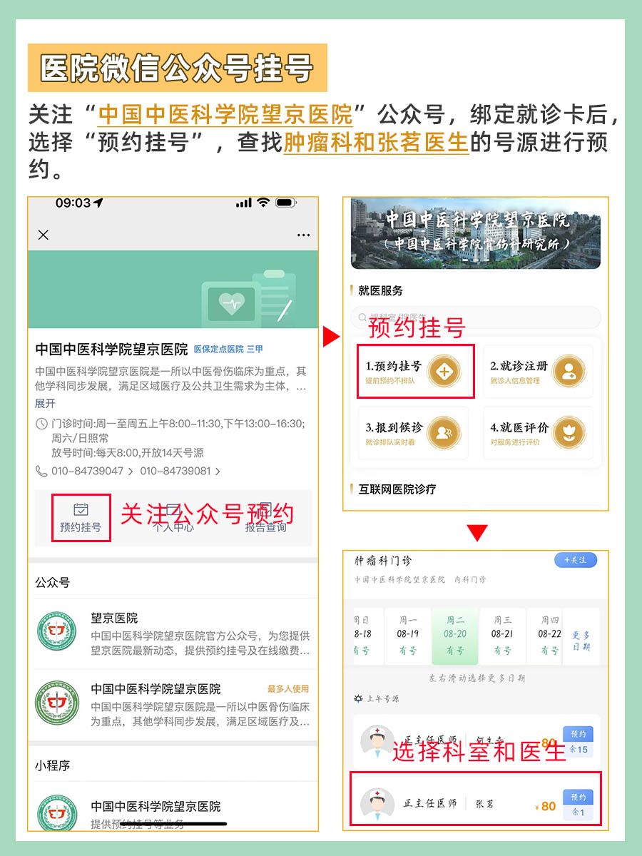 北京望京医院张茗医生怎么样?怎么挂号?