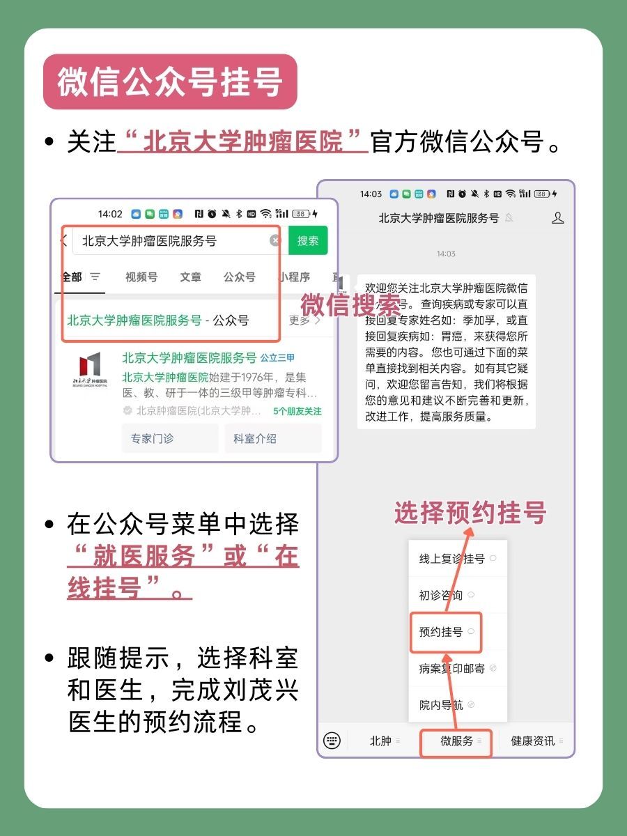 北京大学肿瘤医院刘茂兴医生怎么样?怎么挂号?