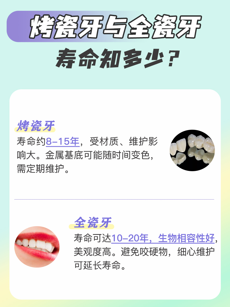 烤瓷牙和全瓷牙，哪个的寿命更长？