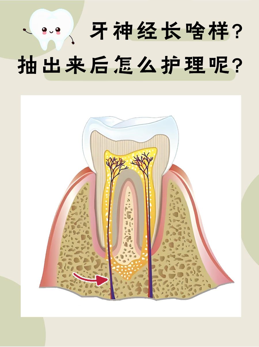 牙神经长啥样？抽出来后怎么护理呢？