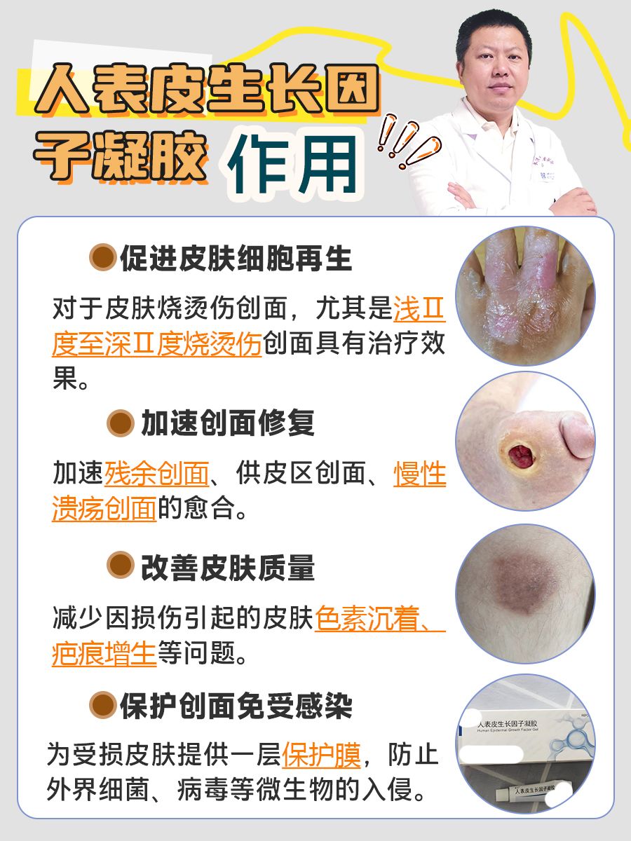 焕肤新宠！人表皮生长因子凝胶作用解析