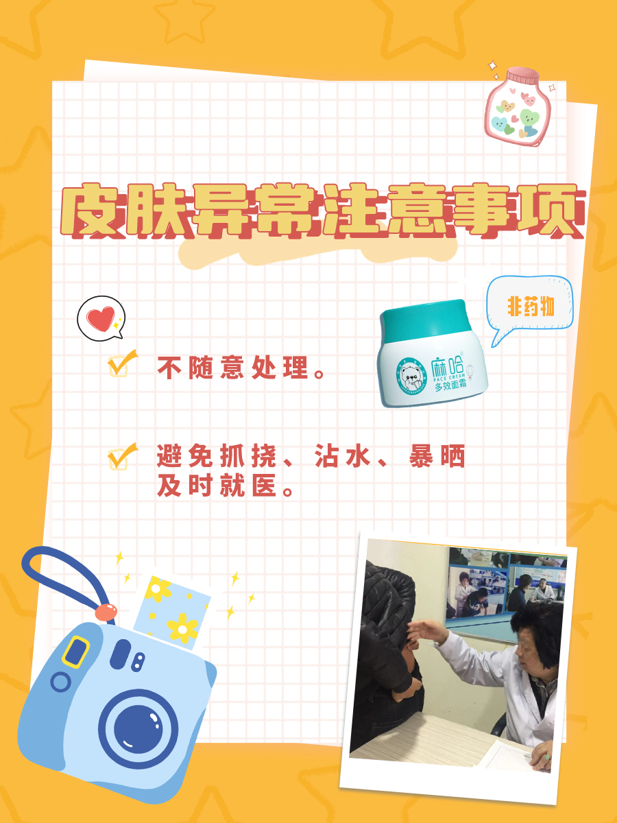 麻哈婴乐霜：疗效靠激素？