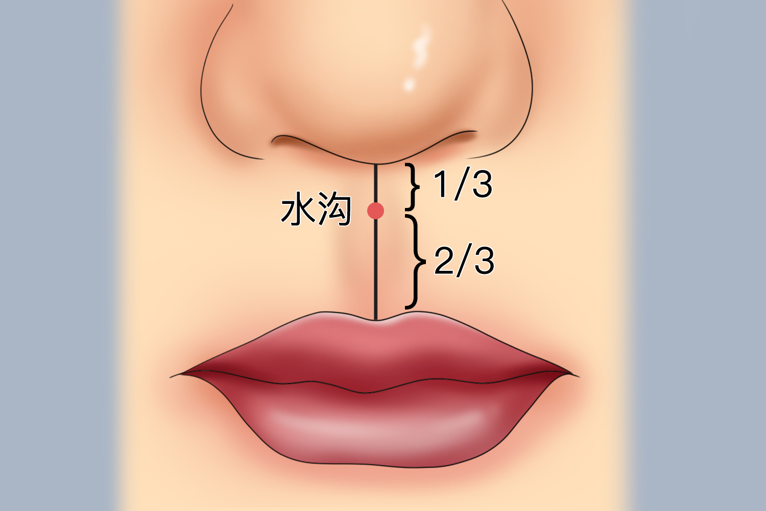 水沟穴位置图 水沟穴位置图