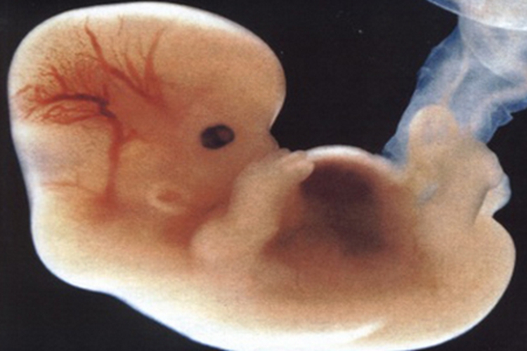 怀孕45天胎儿图