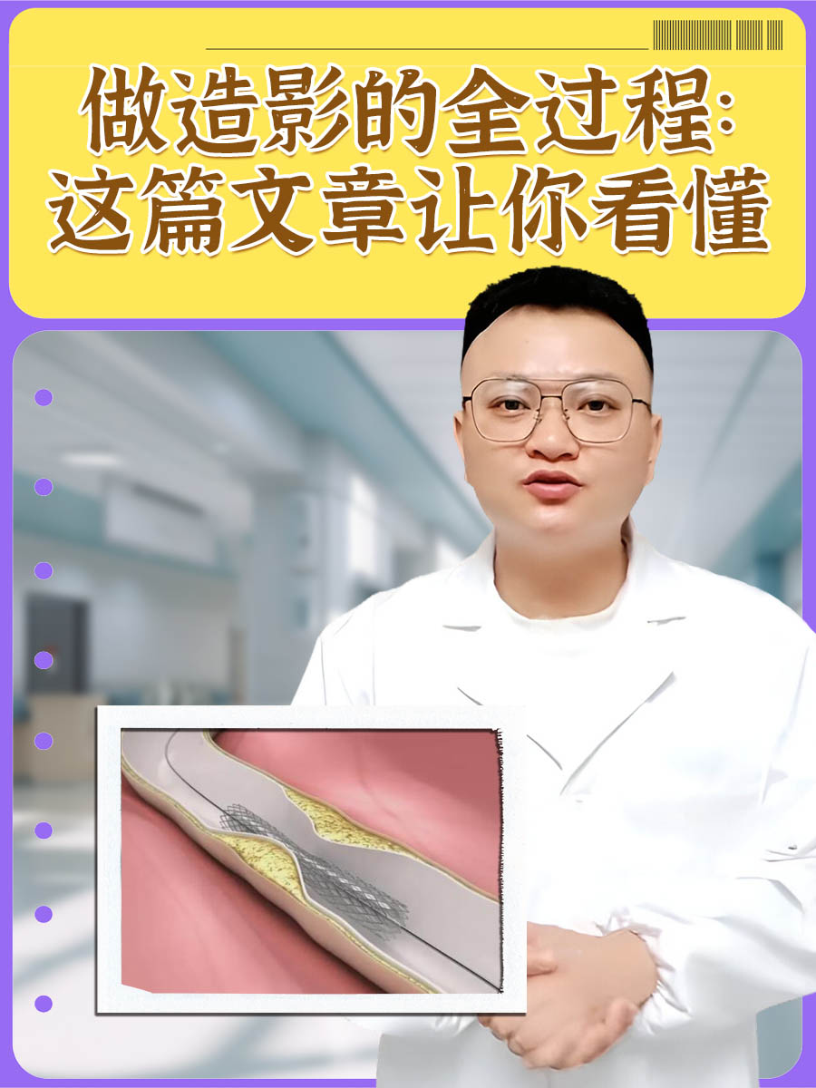 做造影的全过程：这篇文章让你看懂