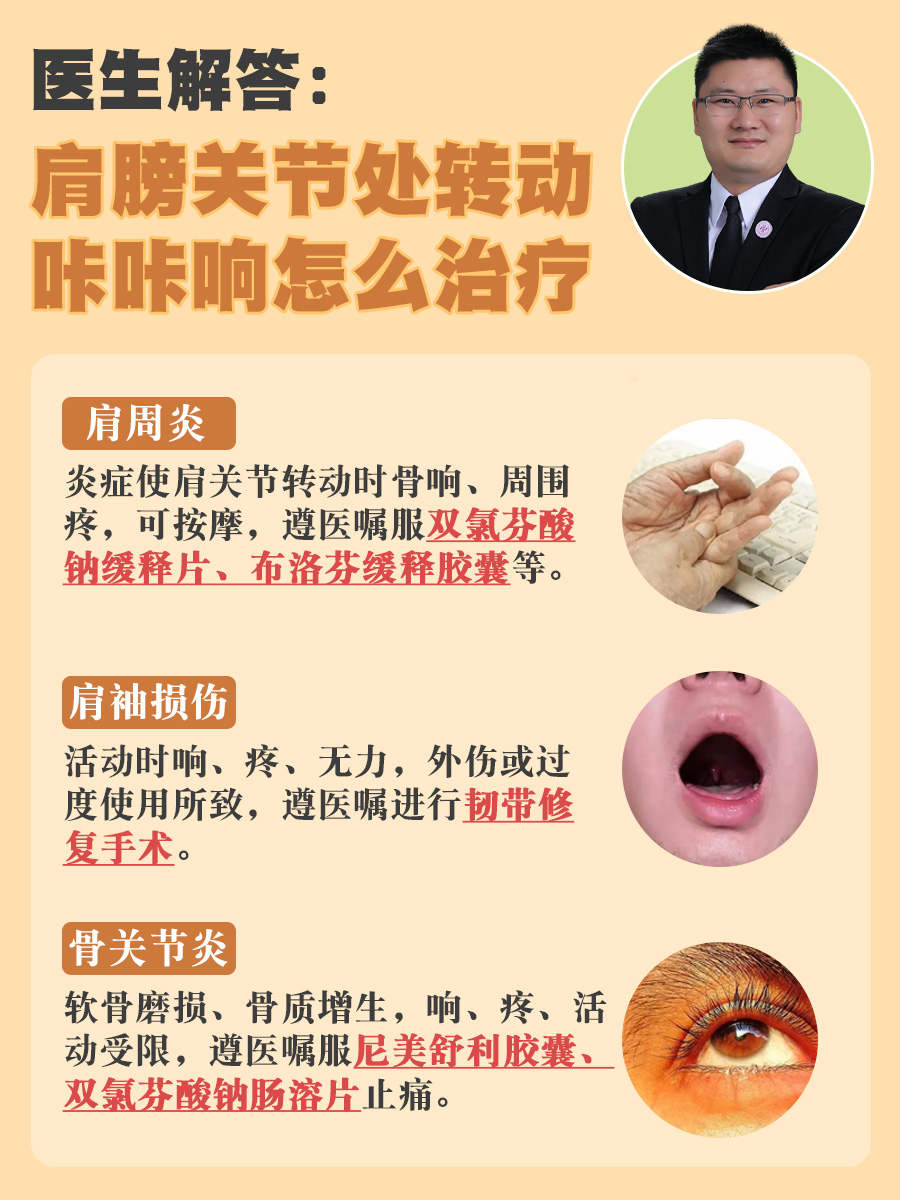 医生解答:肩膀关节处转动咔咔响怎么治疗