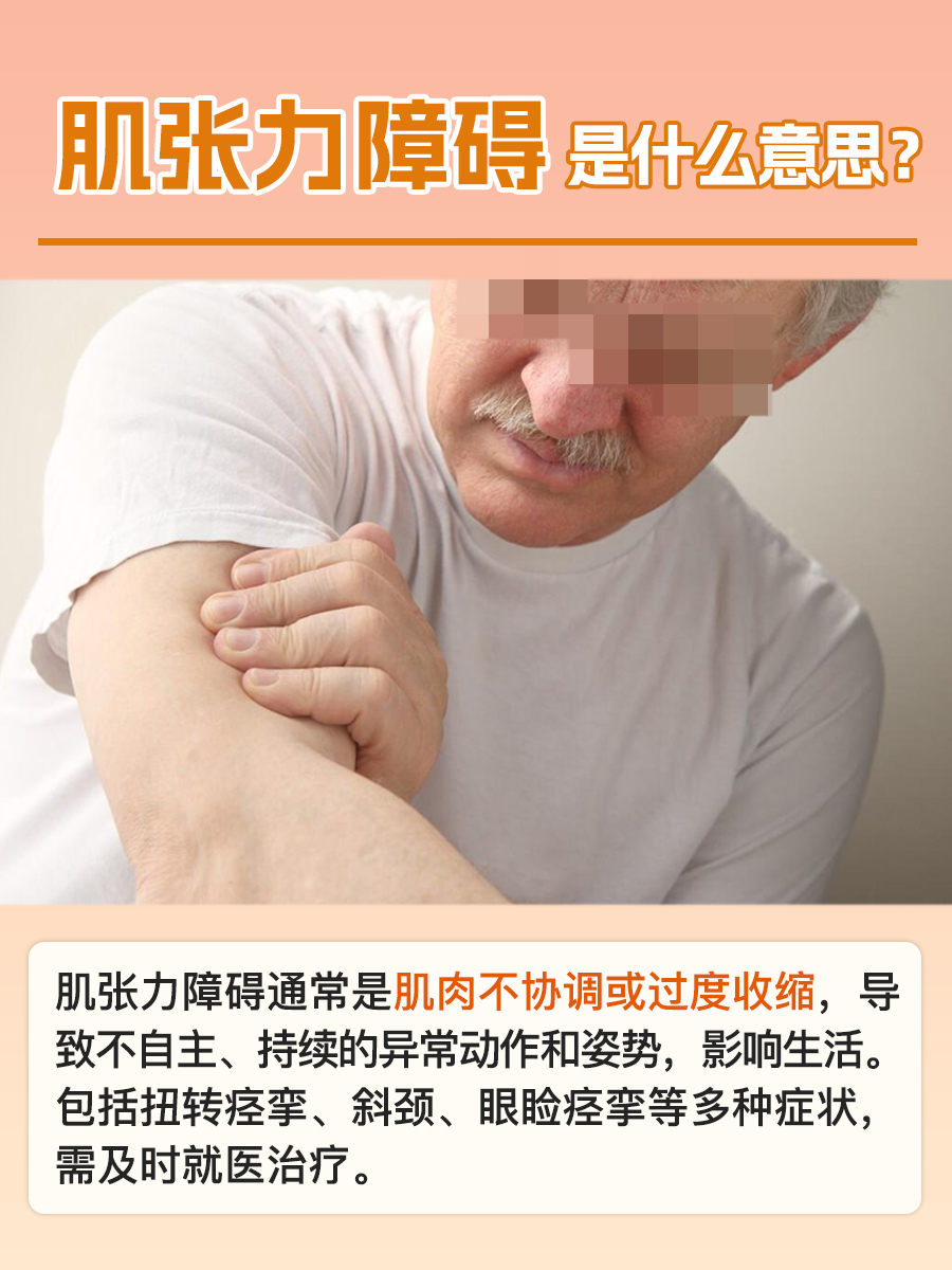 揭晓：肌张力障碍是什么意思