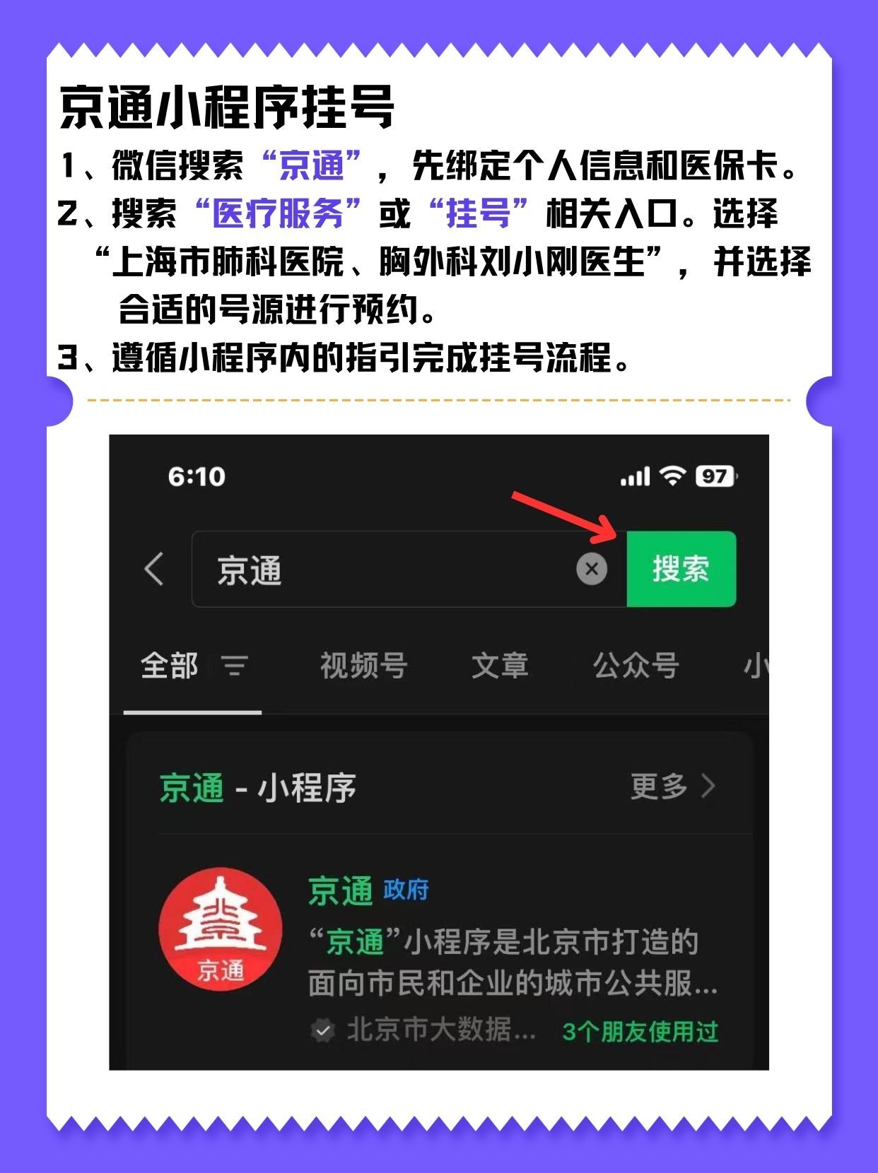 上海市肺科医院刘小刚医生怎么样?怎么挂号?