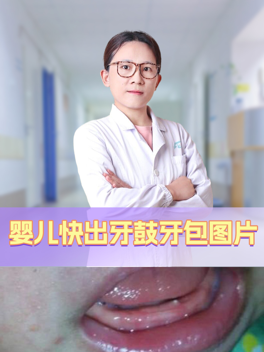 婴儿快出牙鼓牙包图片