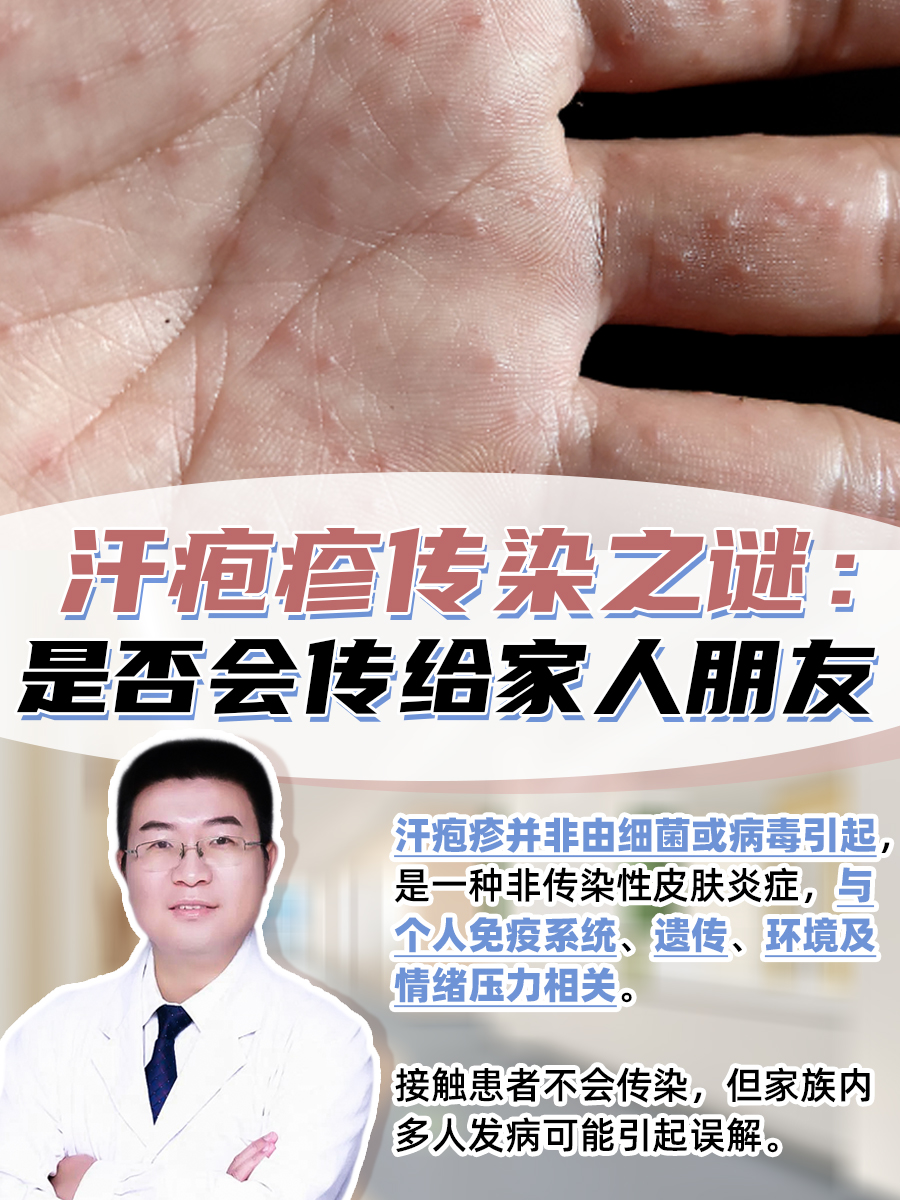 汗疱疹传染之谜：是否会传给家人朋友