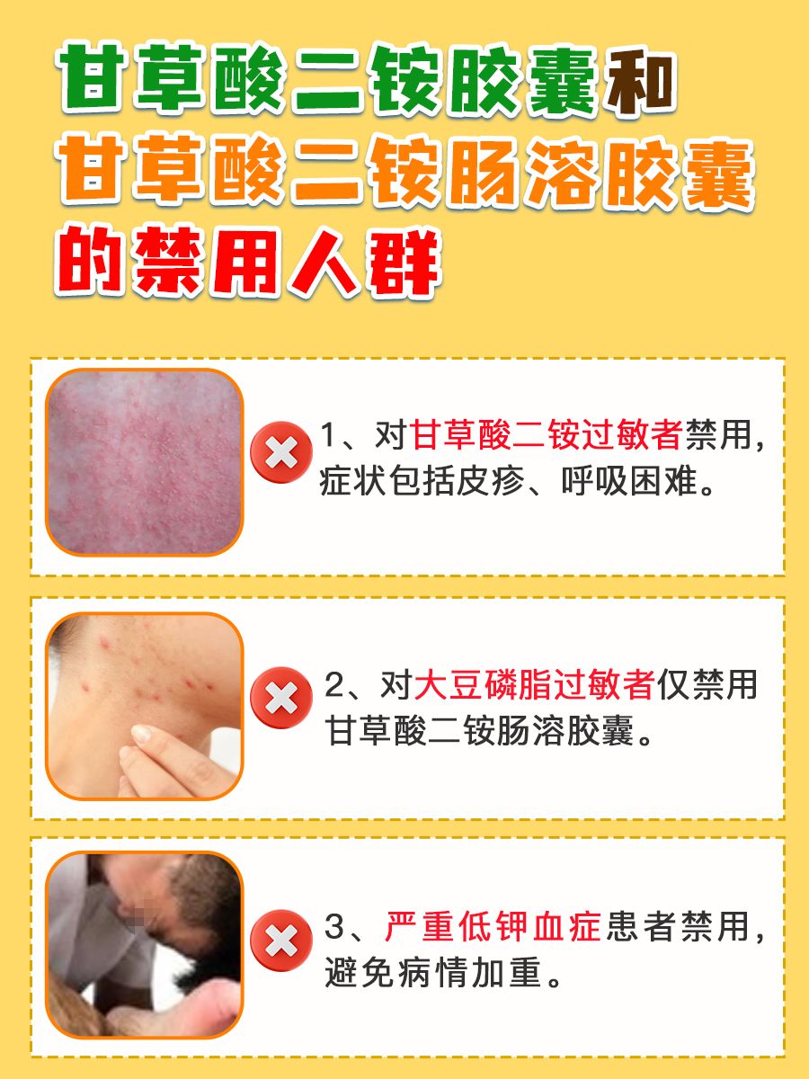 甘草酸二铵胶囊PK甘草酸二铵肠溶胶囊：看区别