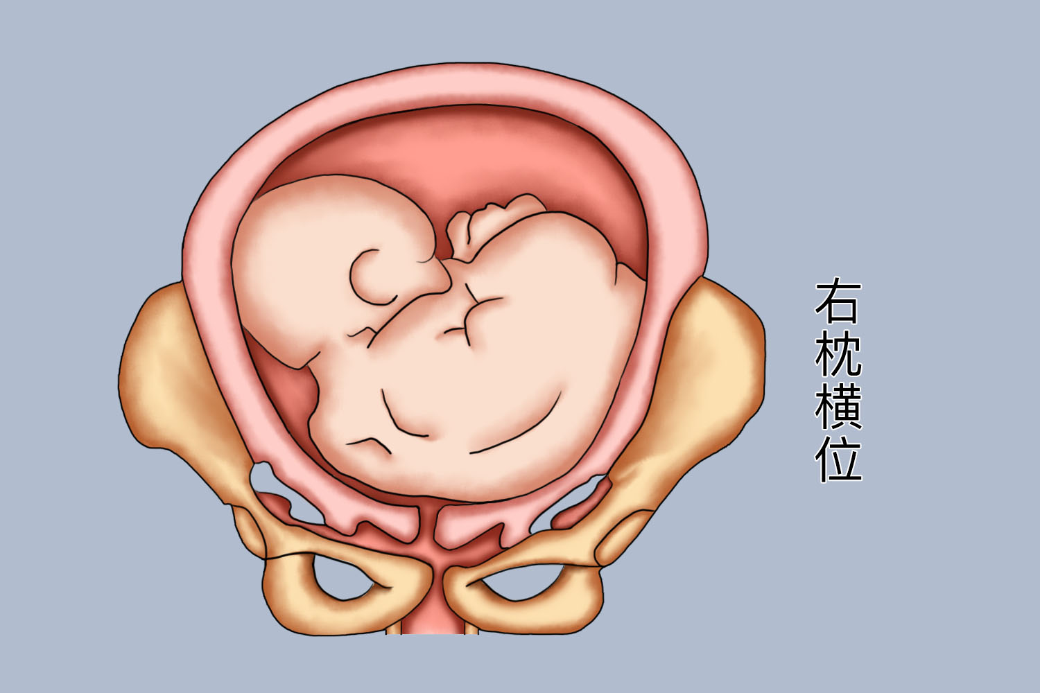 胎心在右下腹胎儿的姿势可能是右枕横位或右枕前位.