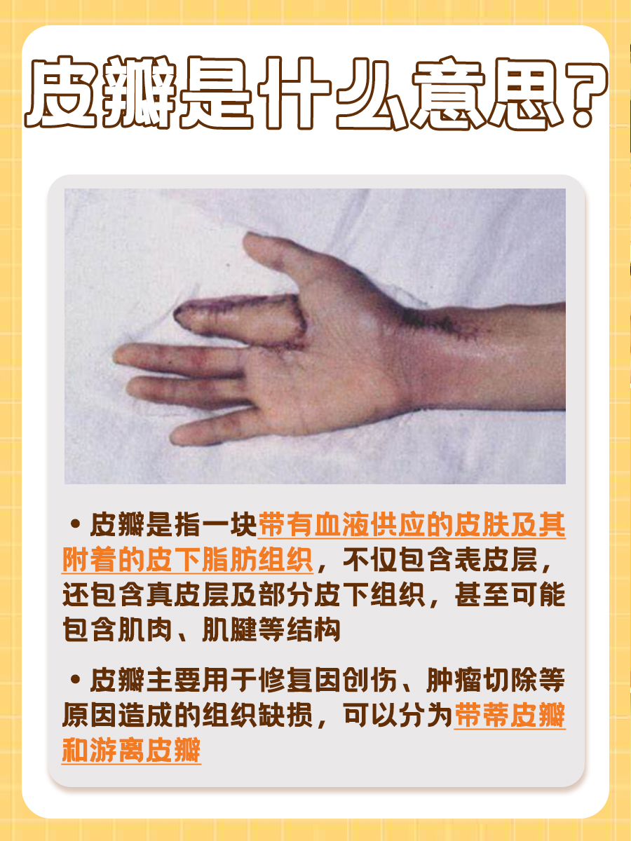 皮瓣是什么意思?医生来告诉你