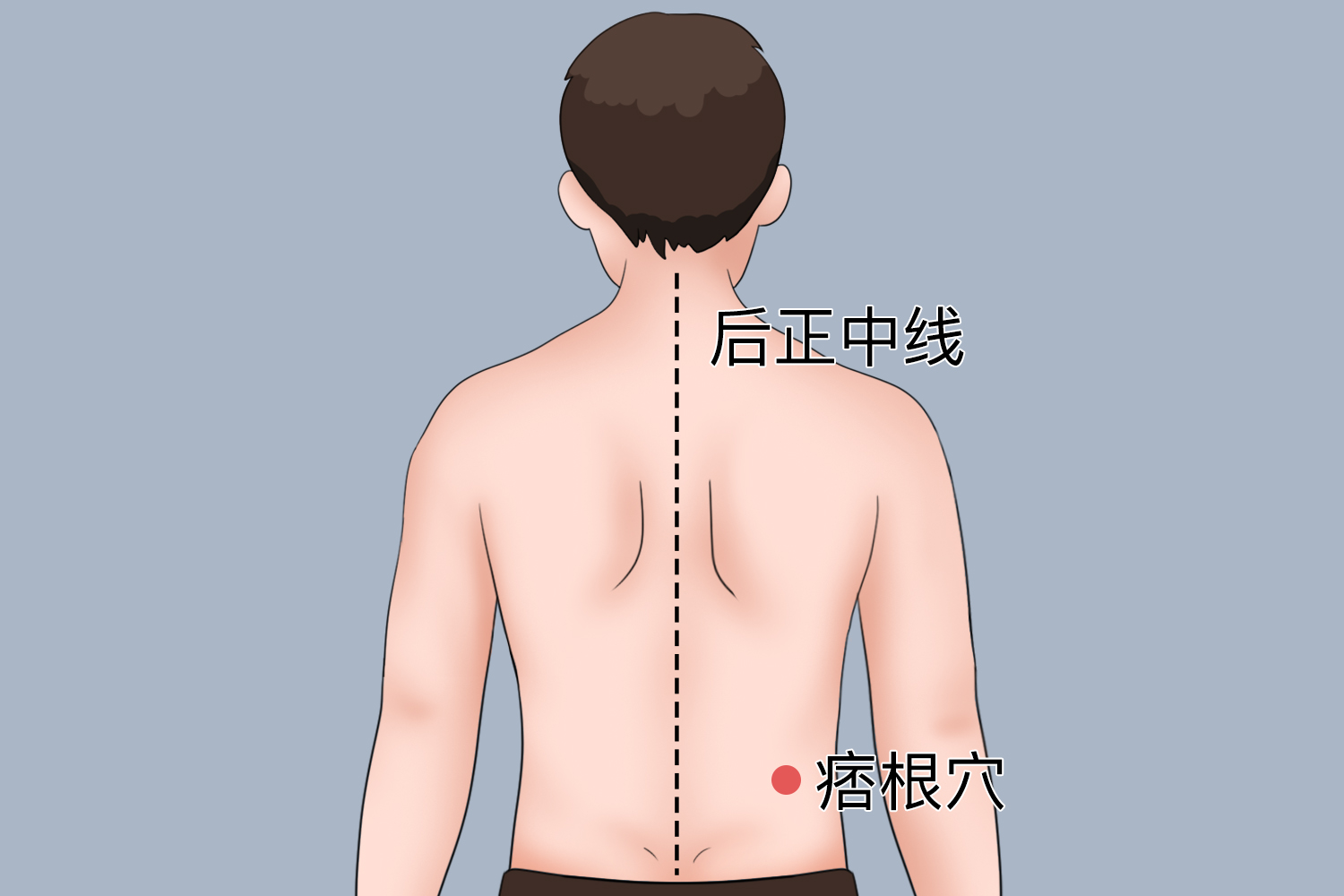 痞根位置图 痞根位置图