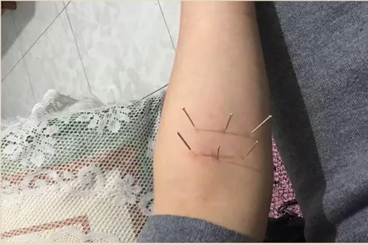 喉灵六针位置图