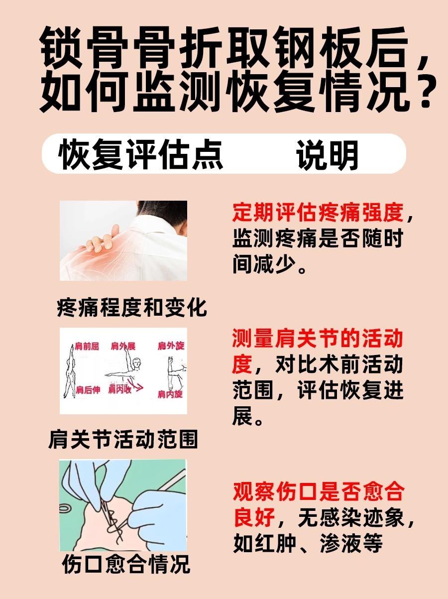 锁骨骨折取钢板,后遗症有哪些?