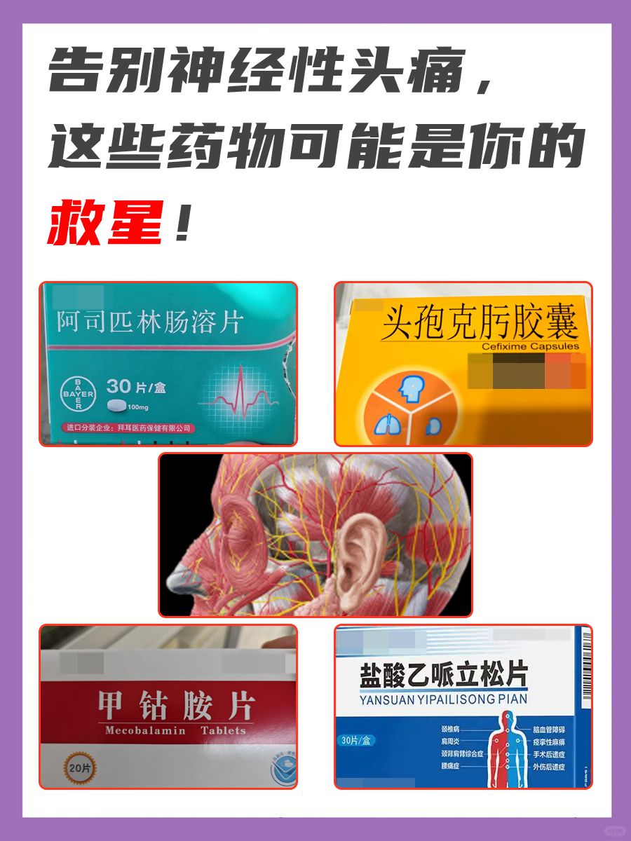 告别神经性头痛，这些药物可能是你的救星！