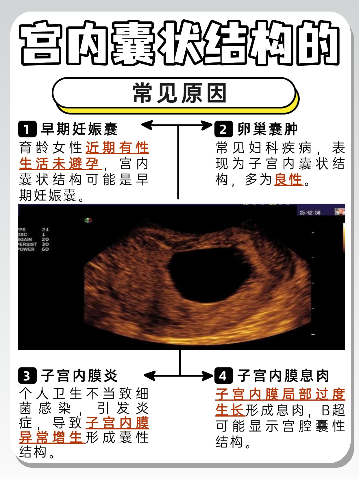 了解你的身体：宫内囊状结构知多少？