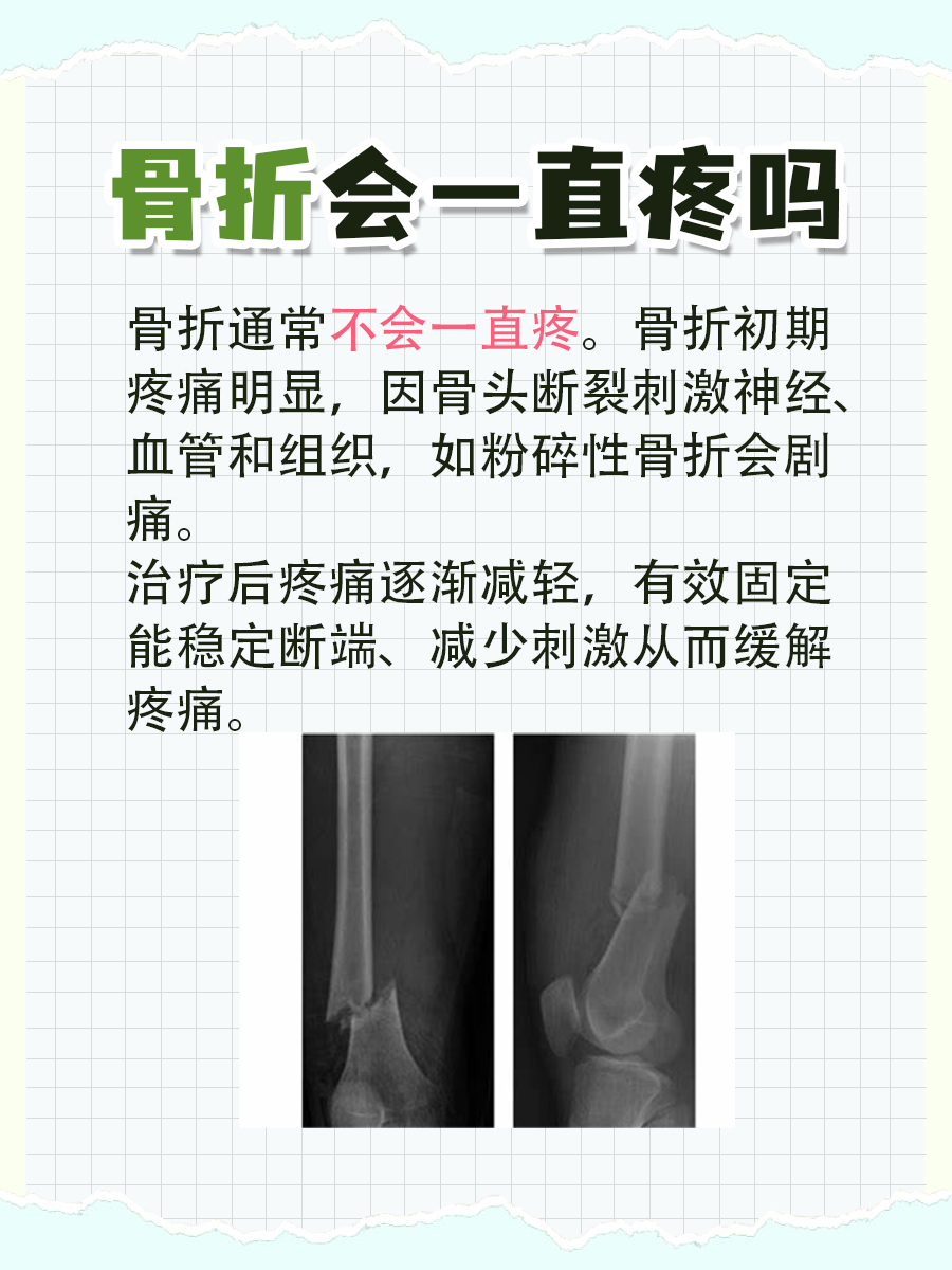 一文解析，骨折会一直疼吗