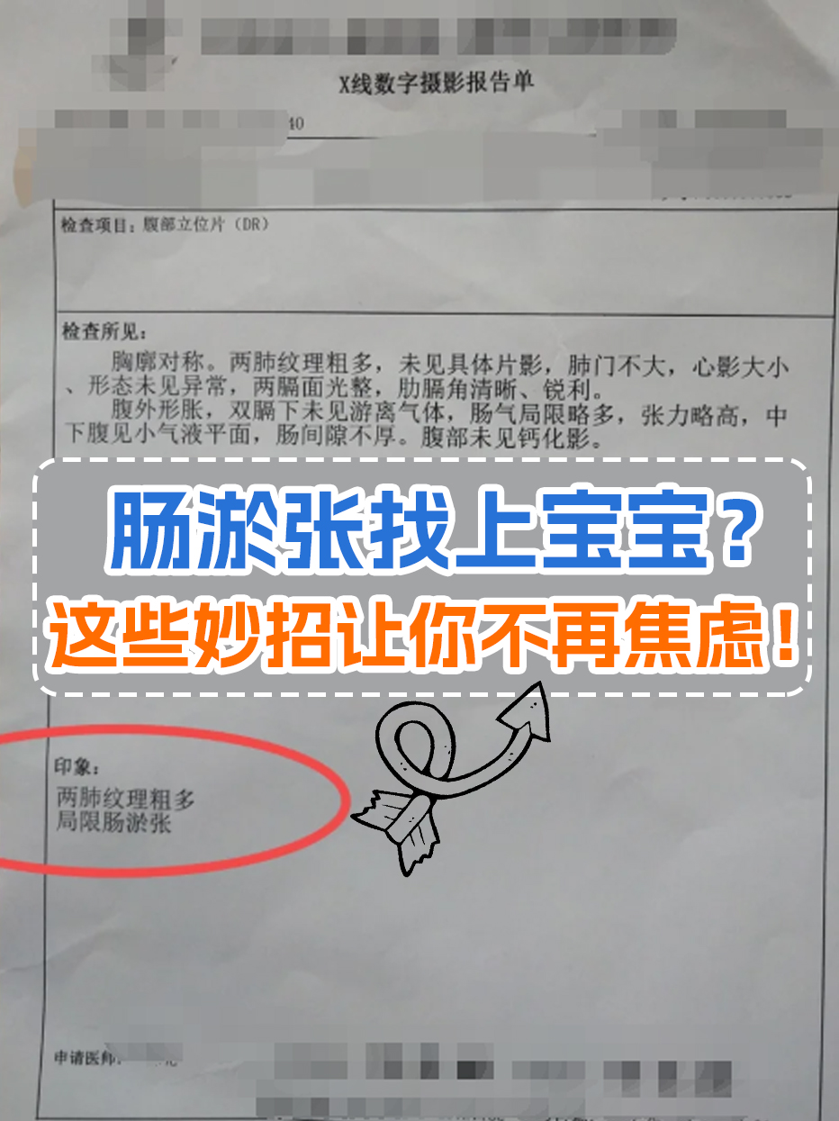 肠淤张找上宝宝？这些妙招让你不再焦虑！