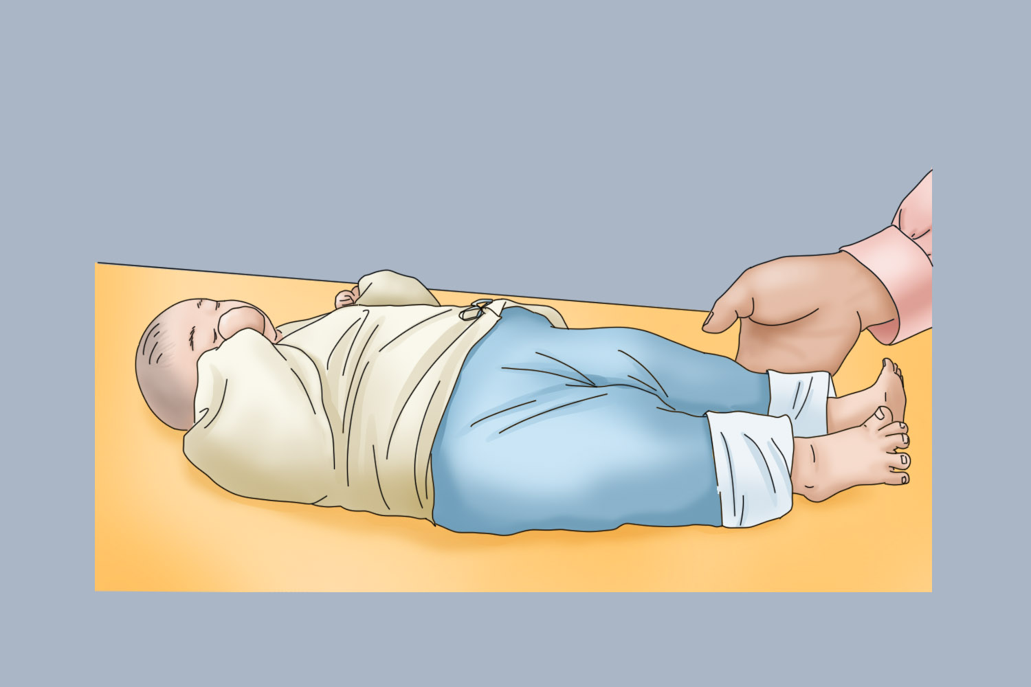 睡姿图痉挛型脑瘫婴儿睡姿图睡姿调整对于非对称性紧张性颈反射的治疗