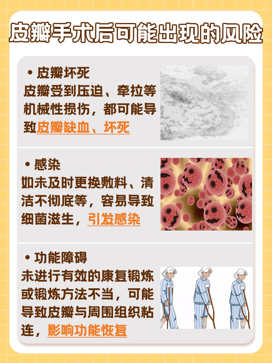 皮瓣是什么意思?医生来告诉你