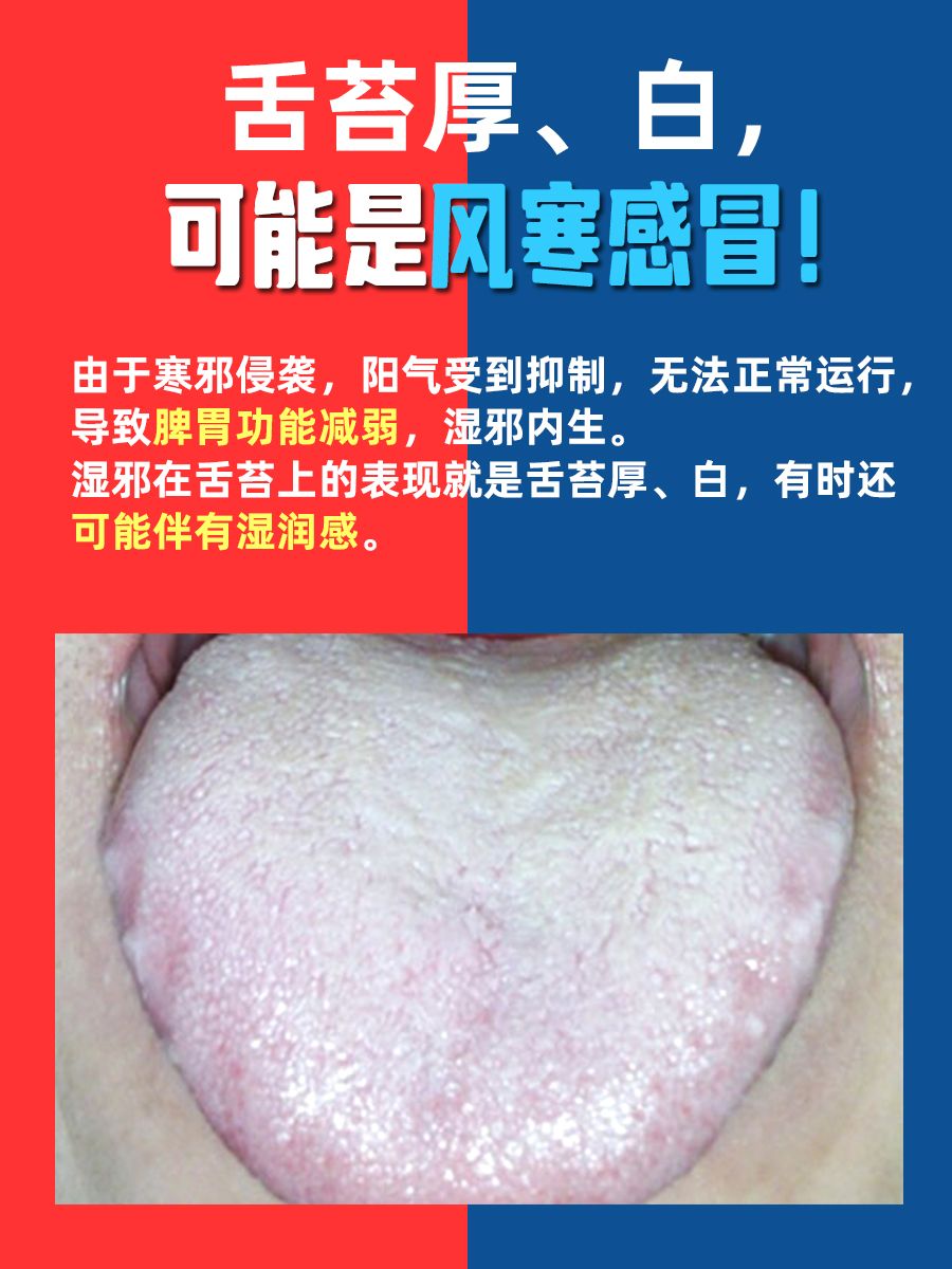 感冒舌苔厚、白，是风热，还是风寒？